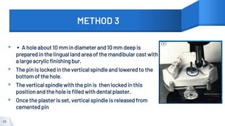 METHOD 3
▸ ▸ A hole about 10 mm in diameter and 10 mm deep is
prepared in the lingual land area of the mandibular cast with
a large acrylic finishing bur.
▸ The pin is locked in the vertical spindle and lowered to the
bottom of the hole.
▸ The vertical spindle with the pin is then locked in this
position and the hole is filled with dental plaster.
▸ Once the plaster is set, vertical spindle is released from
cemented pin
65
 