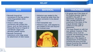 81
RELIEF
SITE
• Beneath lingual bar
connectors or the bar portion
of the linguoplates when
indicated
• Areas in which major
connectors will contact thin
tissue, such as hard areas so
frequently found on lingual or
mandibular ridges and
elevated palatal raphes
• Beneath framework
extensions onto ridge areas
for attachment of resin bases
MATERIAL
• Adhesive wax sealed to the
cast; should be wider than the
major connector to be placed
on it
• Hard baseplate wax
• Adhesive wax, well adapted to
and sealed to the cast beyond
the involved area
THICKNESS
• 32-gauge wax if the slope of
the lingual alveolar ridge is
parallel to the path of
placement; 32-gauge wax
after parallel blockout of
undercuts if the slope of the
lingual alveolar ridge is
undercut to the path of
placement.
• Thin layer flowed on with hot
wax spatula; however, if the
maxillary torus must be
covered, the thickness of the
relief must represent the
difference in the degree of
displacement of the tissues
covering the torus and the
tissues covering the residual
ridges 20-gauge wax
 