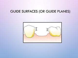 Surveying in prosthodontics powerpoint presentation | PPTX