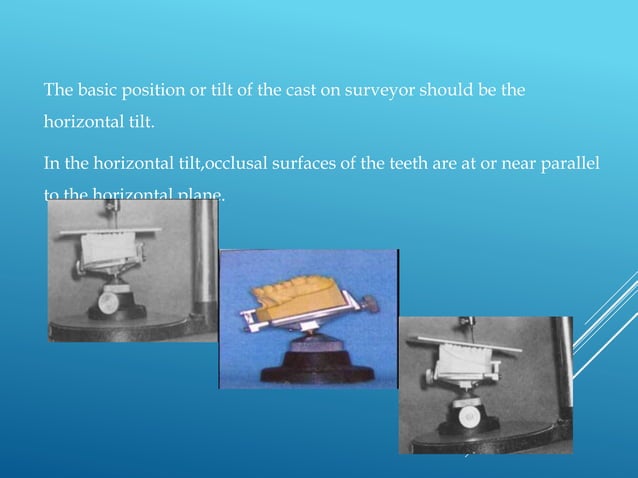 Surveyors and surveying in RPD | PPTX | Dental Health | Diseases and ...