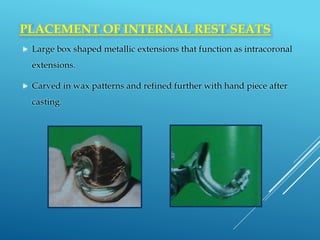 Interproximal Rest Rpd Surveyors and surveying in RPD | PPTX