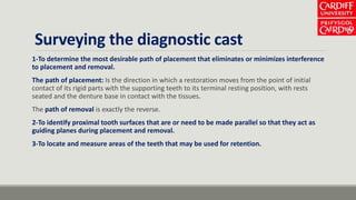 Surveying the diagnostic cast
1-To determine the most desirable path of placement that eliminates or minimizes interference
to placement and removal.
The path of placement: Is the direction in which a restoration moves from the point of initial
contact of its rigid parts with the supporting teeth to its terminal resting position, with rests
seated and the denture base in contact with the tissues.
The path of removal is exactly the reverse.
2-To identify proximal tooth surfaces that are or need to be made parallel so that they act as
guiding planes during placement and removal.
3-To locate and measure areas of the teeth that may be used for retention.
 
