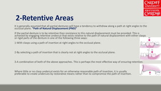 2-Retentive Areas
It is generally assumed that all partial dentures will have a tendency to withdraw along a path at right angles to the
occlusal plane. “Path of Natural Displacement (PND)”
If the partial denture is to be retentive then resistance to this natural displacement must be provided. This is
achieved by engaging retentive undercut that exists relative to the path of natural displacement with either clasps
or rigid parts of the denture in one of the following three ways:
1-With clasps using a path of insertion at right angles to the occlusal plane.
2-By selecting a path of insertion that is clearly not at right angles to the occlusal plane.
3-A combination of both of the above approaches. This is perhaps the most effective way of ensuring retention.
Where little or no clasp undercut exists for an otherwise reasonable path of insertion, it is usually
preferable to create undercuts by restorative means rather than to compromise the path of insertion.
 