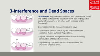 3-Interference and Dead Spaces
Dead spaces: Any unwanted undercut area beneath the survey
line on the surface of the abutment tooth next to the partial
denture framework, or on other teeth enclosed by the
framework.
Dead spaces may be managed in several ways:
Elimination of dead spaces by the removal of tooth
substance (Guide Surfaces Preparation).
By the deliberate enlargement of dead spaces during
construction of the partial denture.
By choosing a path of insertion that eliminates the
unwanted undercut areas.
 