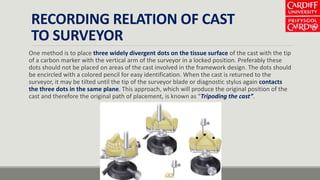 RECORDING RELATION OF CAST
TO SURVEYOR
One method is to place three widely divergent dots on the tissue surface of the cast with the tip
of a carbon marker with the vertical arm of the surveyor in a locked position. Preferably these
dots should not be placed on areas of the cast involved in the framework design. The dots should
be encircled with a colored pencil for easy identification. When the cast is returned to the
surveyor, it may be tilted until the tip of the surveyor blade or diagnostic stylus again contacts
the three dots in the same plane. This approach, which will produce the original position of the
cast and therefore the original path of placement, is known as “Tripoding the cast”.
 
