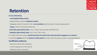 Retention
Can be achieved by:
well-adapted fitting surface.
Appropriately contoured polished surfaces.
Engaging a ‘path of insertion’ that is not coincident with the ‘path of natural displacement’.
Clasps, which are broadly divided into:
Occlusally approaching clasps. (e.g.; C-clasp, ring, reversed, extended arm)
Gingivally approaching clasps. (e.g.; I-bar, T-bar, L-bar)
For cobalt-chromium clasps, only the terminal one-third of the clasp should be engaged in an undercut.
It should be passive when the denture is fully seated but helps retain the denture when it is being displaced.
Insufficient undercut:
Recontour tooth with composite.
Grind a depression in the enamel.
Milled/surveyed restoration.
 