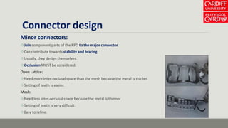 Connector design
Minor connectors:
Join component parts of the RPD to the major connector.
Can contribute towards stability and bracing.
Usually, they design themselves.
Occlusion MUST be considered.
Open Lattice:
Need more inter-occlusal space than the mesh because the metal is thicker.
Setting of teeth is easier.
Mesh:
Need less inter-occlusal space because the metal is thinner
Setting of teeth is very difficult.
Easy to reline.
 