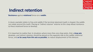 Indirect retention
Resistance against rotational forces on a saddle.
A classic example relates to free-end saddle if the terminal abutment tooth is clasped, the saddle
can rotate around this tooth. Placing an ‘indirect retainer’ anterior to this clasp allows resistance
to these rotational forces to develop.
It is important to realize that, in situations where more than one clasp exists, that a clasp axis
develops, and indirect retainers should be placed on the opposite side to the saddle rotational
forces, and as far away from this axis as possible, to reduce displacement of the denture.
 