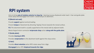 RPI system
Aims to bring axis of rotation anterior to clasp tip > bearing mucosa displaced under load > I-bar and guide plate
move away and disengage from tooth > avoid torque on abutment.
R [Mesial rest seat]:
Provide support against vertical loading.
Prevent torque of abutment by directing ‘tipping’ forces towards the mesial surface.
P.S: The abutment tooth is usually supported on the mesial side by adjacent teeth.
Mesio-lingual minor connector reciprocate clasp action along with the guide plate.
P [Guide plate]:
Provides bracing to RPD.
Provides reciprocation to the abutment tooth against the clasp action.
I [I-bar]:
Provides direct retention when RPD rotate away from ridge.
Disengaged when RPD displaced towards the ridge.
 