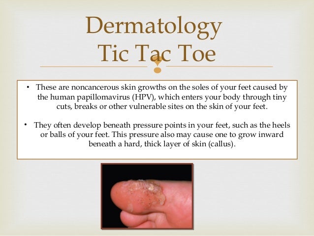 Case study developing thick skin 05 picture