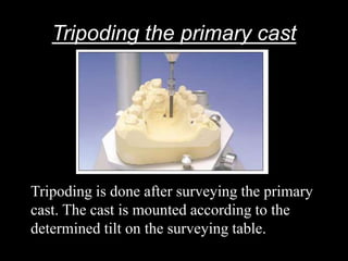 Tripoding the primary cast
Tripoding is done after surveying the primary
cast. The cast is mounted according to the
determined tilt on the surveying table.
 