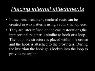 Placing internal attachments
• Intracoronal retainers, occlusal rests can be
created in wax patterns using a rotary handpiece.
• They are later refined on the cast restorations,the
intracoronal retainer is similar to hook or a loop.
The loop like structure is placed within the crown
and the hook is attached to the prosthesis. During
the insertion the hook gets locked into the loop to
provide retention.
 
