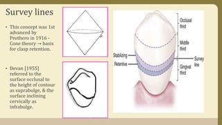 Survey lines
• This concept was 1st
advanced by
Prothero in 1916 -
Cone theory → basis
for clasp retention.
• Devan [1955]
referred to the
surface occlusal to
the height of contour
as suprabulge, & the
surface inclining
cervically as
infrabulge.
 