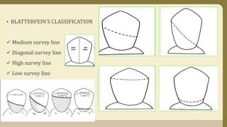 • BLATTERFEIN’S CLASSIFICATION
 Medium survey line
 Diagonal survey line
 High survey line
 Low survey line
 
