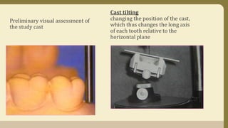 Preliminary visual assessment of
the study cast
Cast tilting
changing the position of the cast,
which thus changes the long axis
of each tooth relative to the
horizontal plane
 