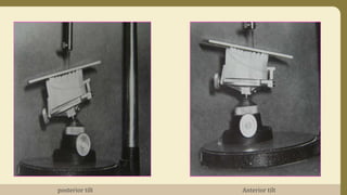 Anterior tiltposterior tilt
 
