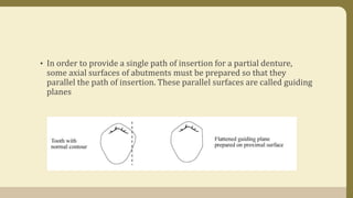 • In order to provide a single path of insertion for a partial denture,
some axial surfaces of abutments must be prepared so that they
parallel the path of insertion. These parallel surfaces are called guiding
planes
 