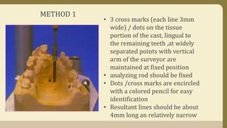 METHOD 1
• 3 cross marks (each line 3mm
wide) / dots on the tissue
portion of the cast, lingual to
the remaining teeth ,at widely
separated points with vertical
arm of the surveyor are
maintained at fixed position
• analyzing rod should be fixed
• Dots /cross marks are encircled
with a colored pencil for easy
identification
• Resultant lines should be about
4mm long an relatively narrow
 