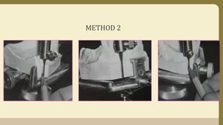 METHOD 2
 