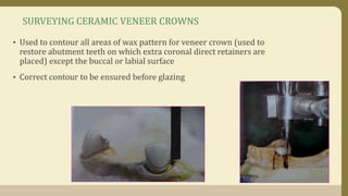 SURVEYING CERAMIC VENEER CROWNS
• Used to contour all areas of wax pattern for veneer crown (used to
restore abutment teeth on which extra coronal direct retainers are
placed) except the buccal or labial surface
• Correct contour to be ensured before glazing
 