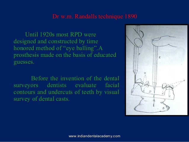 Surveyors Surveying In Dentistry Dentistry Dental Implants - 7