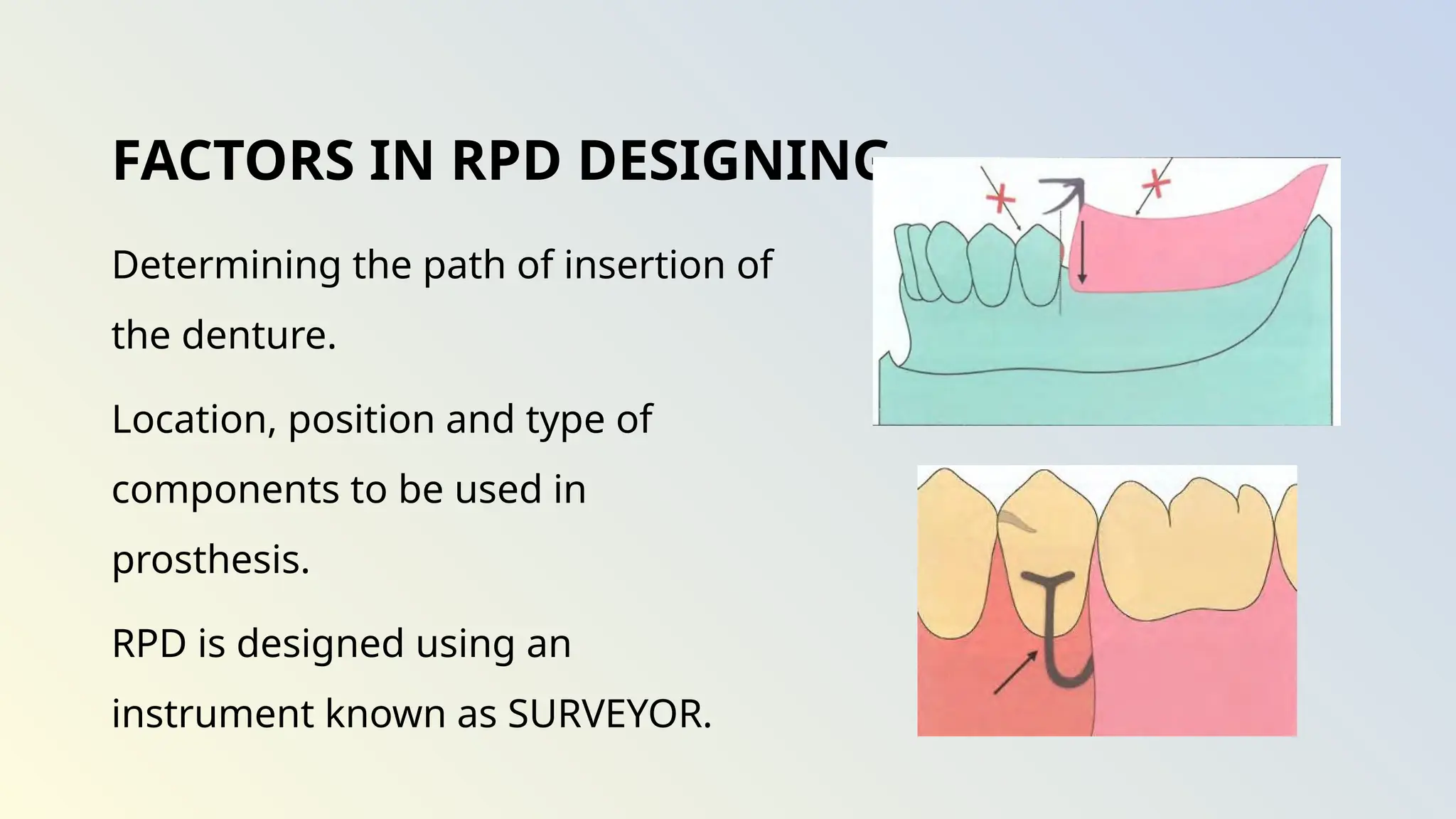 SURVEYOR AND SURVEYING IN PROSTHODONTICS | PPTX