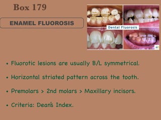 ENAMEL FLUOROSIS
• Fluorotic lesions are usually B/L symmetrical.

• Horizontal striated pattern across the tooth. 

• Premolars > 2nd molars > Maxillary incisors.

• Criteria: Dean’s Index.
Box 179
 