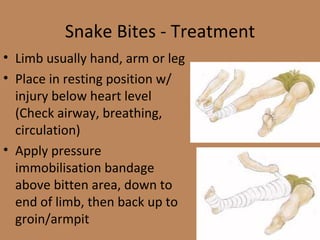 Snake Bites - Treatment Limb usually hand, arm or leg Place in resting position w/ injury below heart level (Check airway, breathing, circulation) Apply pressure immobilisation bandage above bitten area, down to end of limb, then back up to groin/armpit 