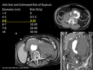 Ann Intern Med. 2005 Feb 1. 142(3):198-202
AAA Size and Estimated Risk of Rupture
Diameter (cm) Risk (%/y)
< 4 0
4-5 0.5-5
5-6 3-15
6-7 10-20
7-8 20-40
>8 30-50
 