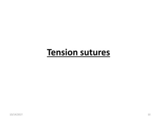 Tension sutures
10/14/2017 10
 