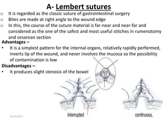 A- Lembert sutures
o It is regarded as the classic suture of gastrointestinal surgery
o Bites are made at right angle to the wound edge
o In this, the course of the suture material is far-near and near-far and
considered as the one of the safest and most useful stitches in rumenotomy
and cesarean section
Advantages –
• It is a simplest pattern for the internal organs, relatively rapidly performed,
inverts lip of the wound, and never involves the mucosa so the possibility
of contamination is low
Disadvantages –
• It produces slight stenosis of the bowel
10/14/2017 16
 