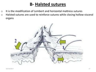 B- Halsted sutures
o It is the modification of Lembert and horizontal mattress sutures
o Halsted sutures are used to reinforce sutures while closing hollow visceral
organs
10/14/2017 17
 