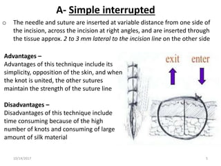 A- Simple interrupted
o The needle and suture are inserted at variable distance from one side of
the incision, across the incision at right angles, and are inserted through
the tissue approx. 2 to 3 mm lateral to the incision line on the other side
Advantages –
Advantages of this technique include its
simplicity, opposition of the skin, and when
the knot is united, the other sutures
maintain the strength of the suture line
Disadvantages –
Disadvantages of this technique include
time consuming because of the high
number of knots and consuming of large
amount of silk material
10/14/2017 5
 