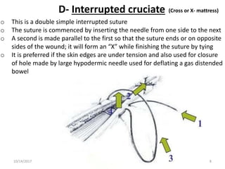 D- Interrupted cruciate (Cross or X- mattress)
o This is a double simple interrupted suture
o The suture is commenced by inserting the needle from one side to the next
o A second is made parallel to the first so that the suture ends or on opposite
sides of the wound; it will form an “X” while finishing the suture by tying
o It is preferred if the skin edges are under tension and also used for closure
of hole made by large hypodermic needle used for deflating a gas distended
bowel
10/14/2017 8
 