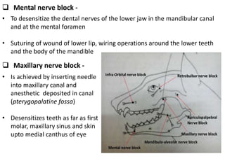 Mental nerve block -
• To desensitize the dental nerves of the lower jaw in the mandibular canal
and at the mental foramen
• Suturing of wound of lower lip, wiring operations around the lower teeth
and the body of the mandible
 Maxillary nerve block -
• Is achieved by inserting needle
into maxillary canal and
anesthetic deposited in canal
(pterygopalatine fossa)
• Desensitizes teeth as far as first
molar, maxillary sinus and skin
upto medial canthus of eye
 
