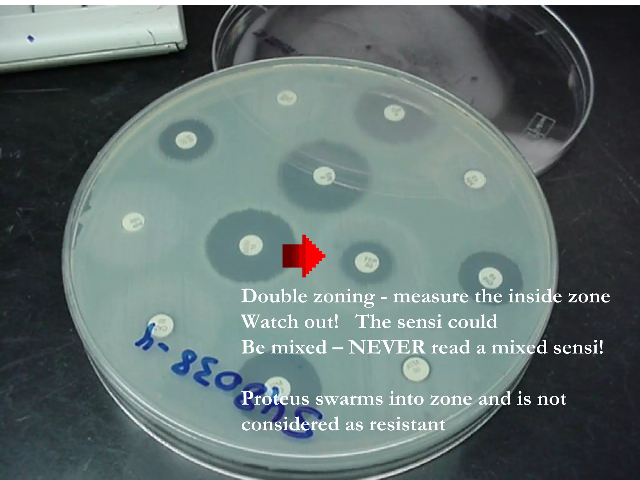 Double zoning - measure the inside zone
Watch out! The sensi could
Be mixed – NEVER read a mixed sensi!
Proteus swarms into zone and is not
considered as resistant
 