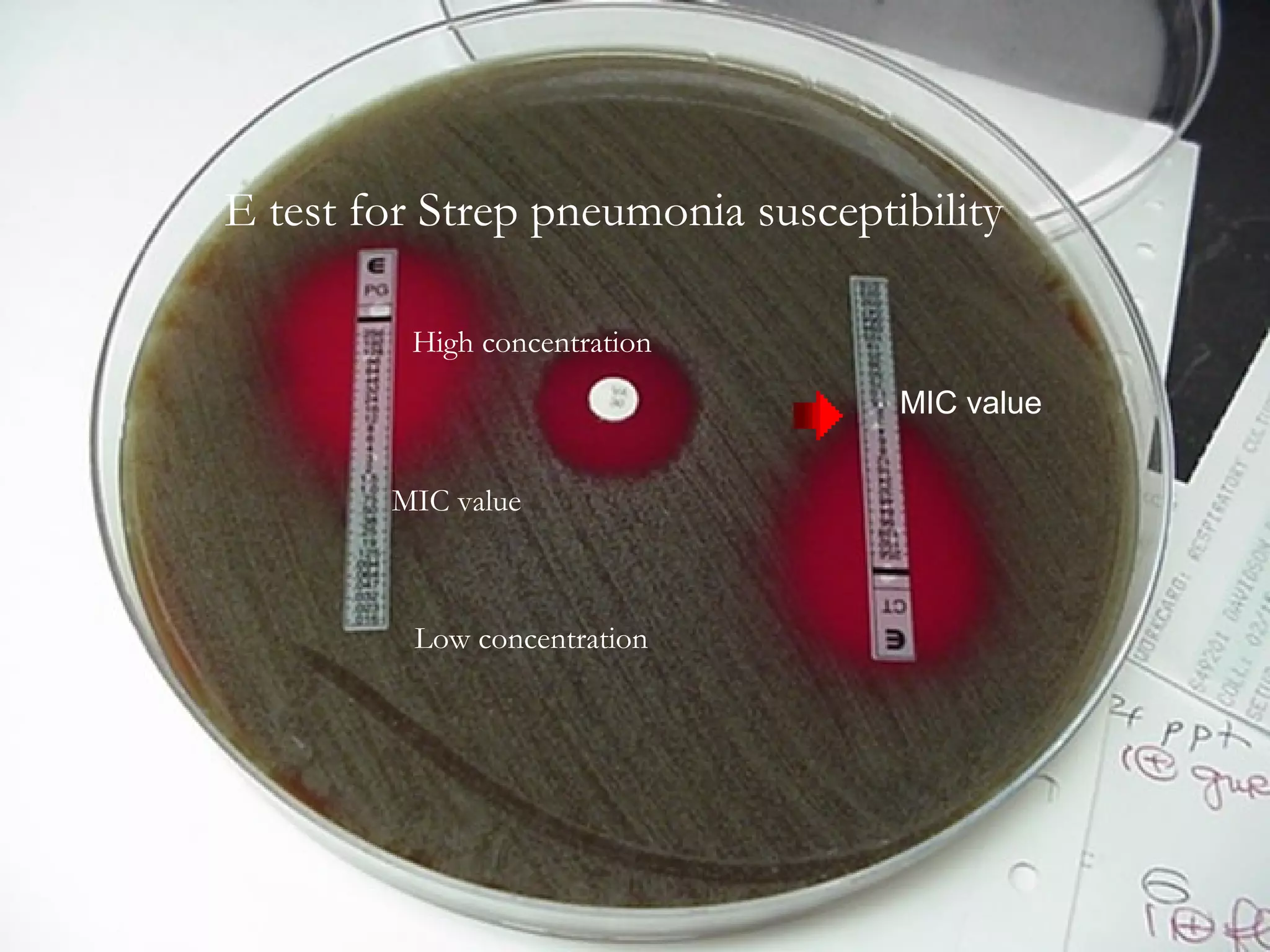 E Test method
E test method
Susceptibility result =
Where growth crosses
The plastic strip
E test for Strep pneumonia susceptibility
Low concentration
High concentration
MIC value
MIC value
 