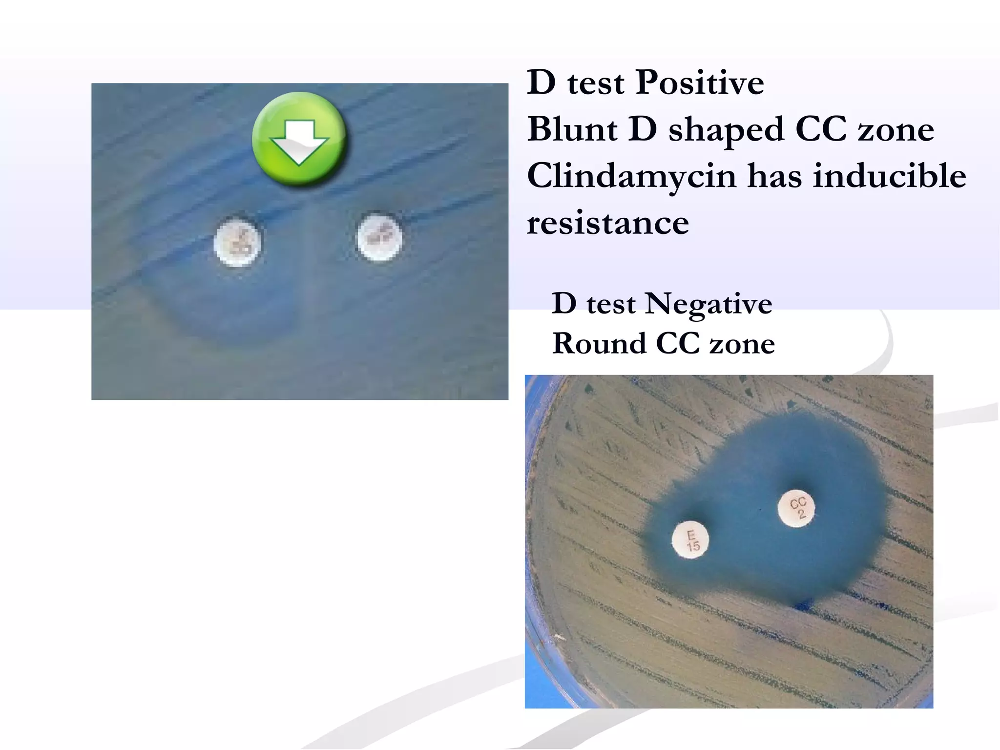 D test Positive
Blunt D shaped CC zone
Clindamycin has inducible
resistance
D test Negative
Round CC zone
 