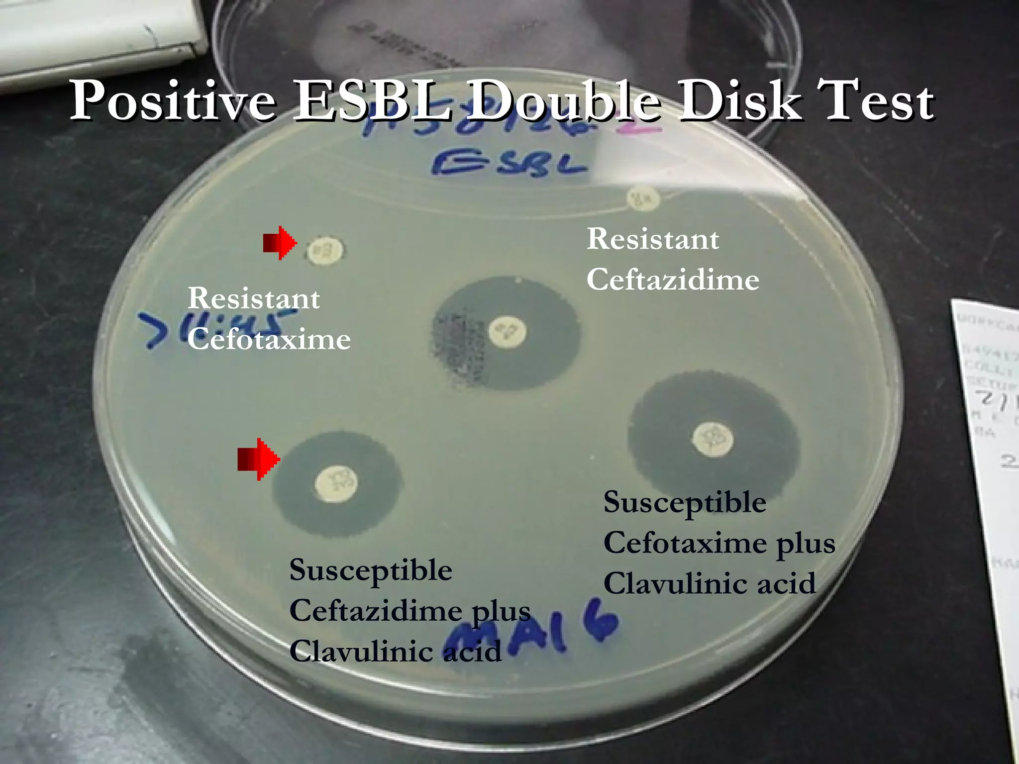 Positive ESBL Double Disk TestPositive ESBL Double Disk Test
Resistant
Cefotaxime
Resistant
Ceftazidime
Susceptible
Ceftazidime plus
Clavulinic acid
Susceptible
Cefotaxime plus
Clavulinic acid
 