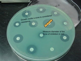 Kirby Bauer
Disk Diffusion
Measure diameter in mm– across center of the
Disk – for each antibiotic disk
Colonies growing into zones is considered
Resistant to that antibiotic
Growth inside a zone is considered
resistance
Measure diameter of the
Zone of inhibition in mm
 