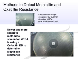 Oxacillin KB= resistant
Newer and more
sensitive
method to
screen for MRSA
is using a
Cefoxitin KB to
determine
Methicillin
resistance
Methods to Detect Methicillin and
Oxacillin Resistance
Oxacillin is no longer
suggested by CLSI for
detecting MRSA
 