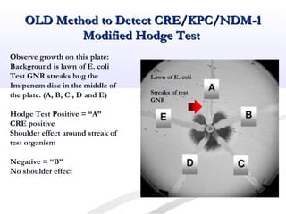 OLD Method to Detect CRE/KPC/NDM-1OLD Method to Detect CRE/KPC/NDM-1
Modified Hodge TestModified Hodge Test
Observe growth on this plate:
Background is lawn of E. coli
Test GNR streaks hug the
Imipenem disc in the middle of
the plate. (A, B, C , D and E)
Hodge Test Positive = “A”
CRE positive
Shoulder effect around streak of
test organism
Negative = “B”
No shoulder effect
Lawn of E. coli
Streaks of test
GNR
 