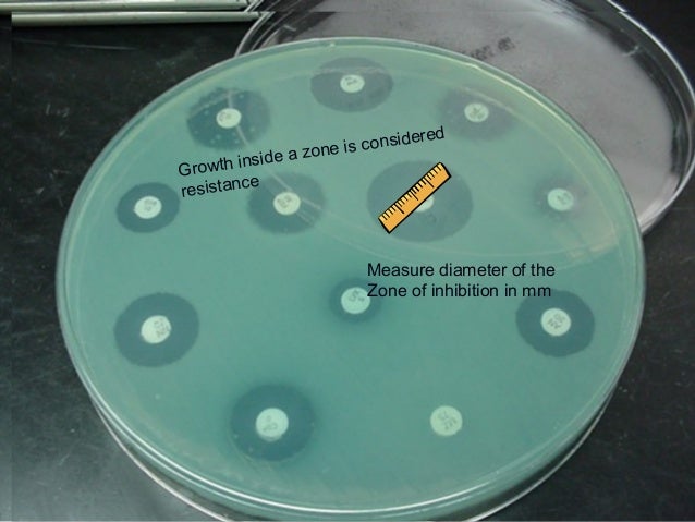 mrsa bacteria pictures #11