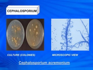 CEPHALOSPORIUM
CULTURE (COLONIES) MICROSCOPIC VIEW
Cephalosporium acremonium
 