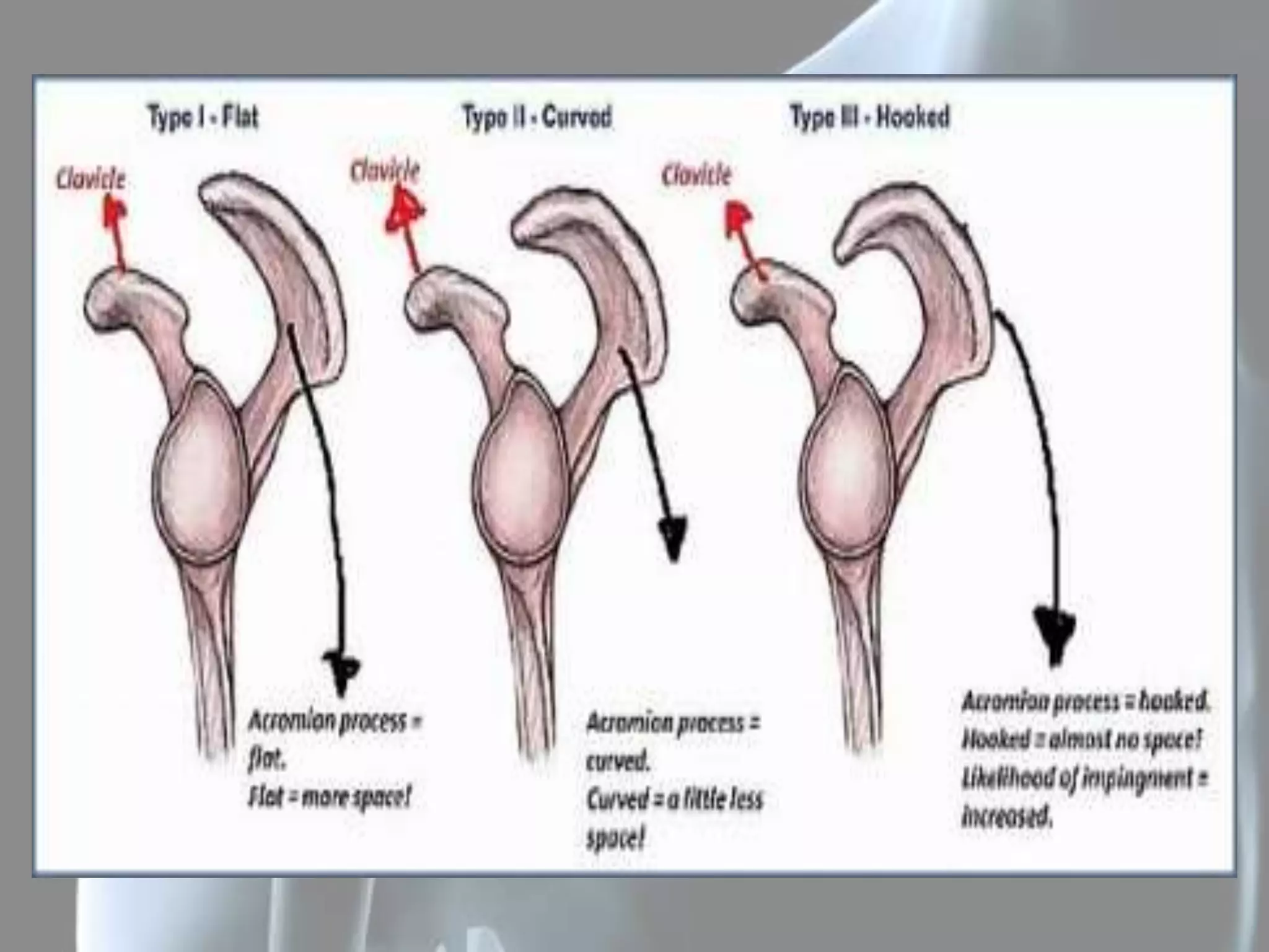 Types Of Shoulder Rotation SHOULDER PATHOLOGIES IN YOUNG ACTIVE PERSONS | PPTX