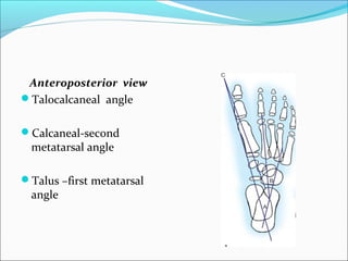 Anteroposterior view
Talocalcaneal angle


Calcaneal-second
  metatarsal angle

Talus –first metatarsal
  angle
 