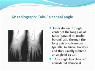 AP radiograph: Talo-Calcaneal angle

                      Lines drawn through
                      center of the long axis of
                      talus (parallel to medial
                      border) and through the
                      long axis of calcaneum
                      (parallel to lateral border),
                      and they usually subtend
                      an angle of 25-40°.
                      Any angle less than 20°
                      considered abnormal
 