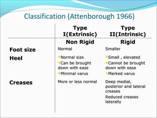 Classification (Attenborough 1966)
                      Type                   Type
                   I(Extrinsic)          II(Intrinsic)
                    Non Rigid                Rigid
Foot size        Normal                Smaller

Heel             Normal size          Small, elevated
                 Can be brought       Cannot be brought
                 down with ease        down with ease
                 Minimal varus        Marked varus


Creases          More or less normal   Deep medial,
                                       posterior and lateral
                                       creases
                                       Reduced creases
                                       laterally
 