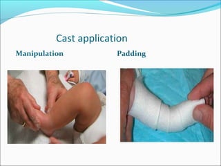 Cast application
Manipulation           Padding
 
