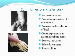 Common errors(Kite errors)
           No manipulation
           Pronation/eversion of 1st
            metatarsal
           Premature dorsiflexion
            of heel
           Counterpressure at
            calcaneocuboid joint
           External rotation
           Below knee casts
           Short splints
 